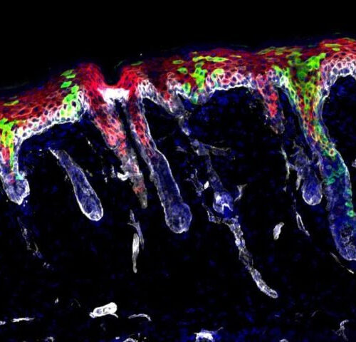 Stem cell memories may drive wound repair—and chronic disease