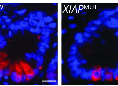 Researchers identify pathway critical for the development and prevention of intestinal inflammation