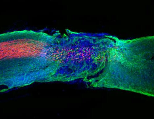 ‘Dancing molecules’ successfully repair severe spinal cord injuries in mice