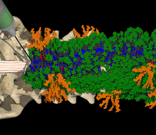 Synthetic Peptides Jump Around to Repair Spinal Injuries