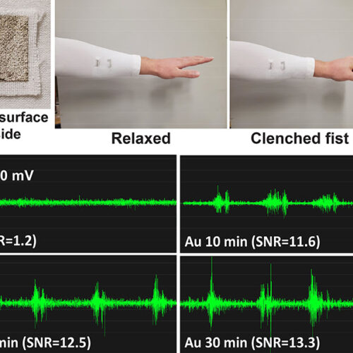 Washable Fabric Measures Electrical Activity of Muscles