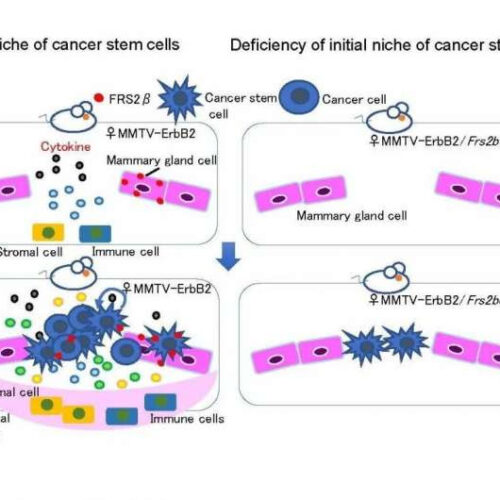 Molecular mechanism of microenvironment creation by FRS2ß for breast cancer carcinogenesis