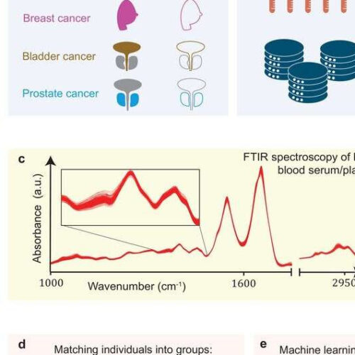 Infrared spectroscopic profiling can pick up molecular traces of solid tumors in blood