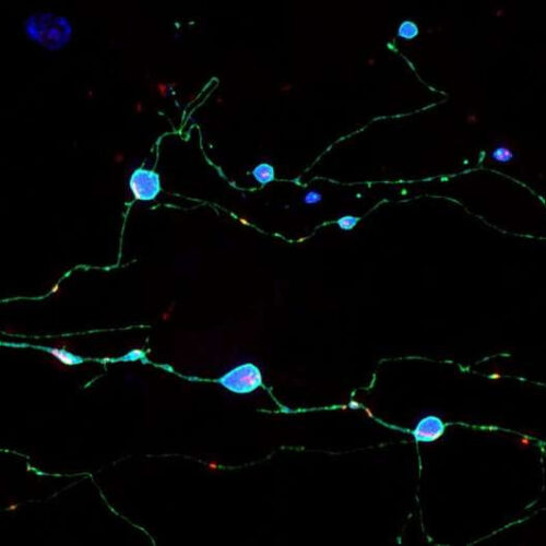 Discovery illuminates how brain cells die in prion diseases