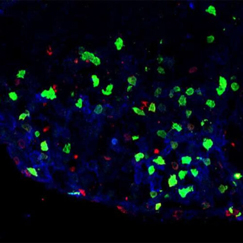 Novel immune cell population may trigger inflammation in multiple sclerosis and other brain disorders