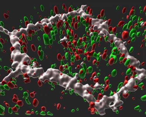 Study traces molecular link from gene to late-onset retinal degeneration