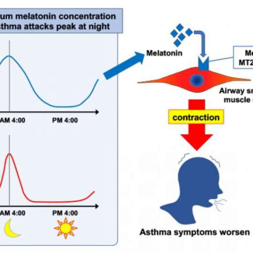 Melatonin exacerbates asthma