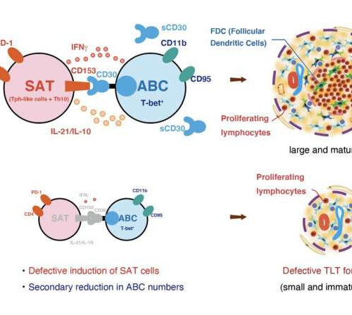 A new drug target for kidney disease