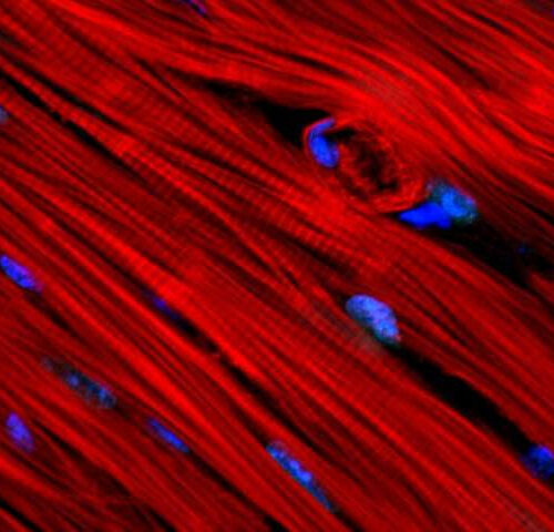 Mechanical forces in a beating heart affect its cells’ DNA, with implications for development and disease