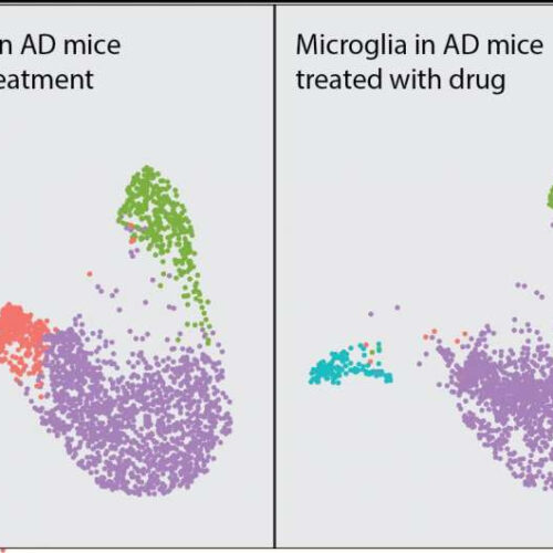 Targeting the brain’s immune cells may help prevent or treat Alzheimer’s disease