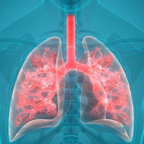 Strategies compared for ruling out pulmonary embolism