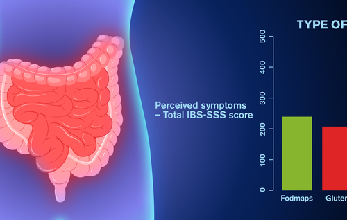 For IBS, specific diets are less important than expected