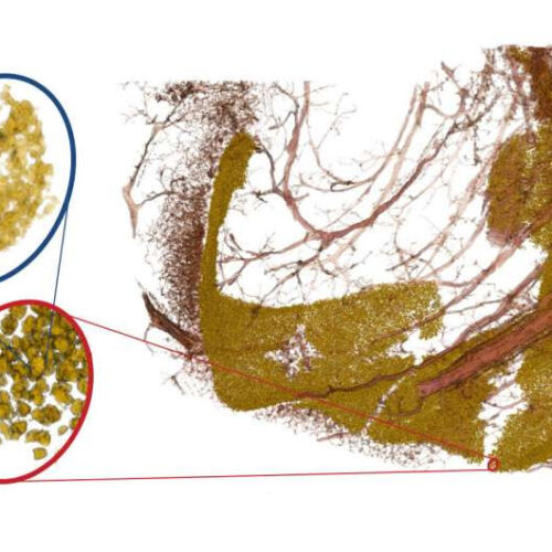 Three-dimensional X-ray image spotlights neurodegenerative disease