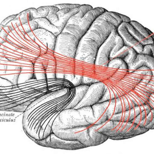 Keeping the aging brain connected with words and music