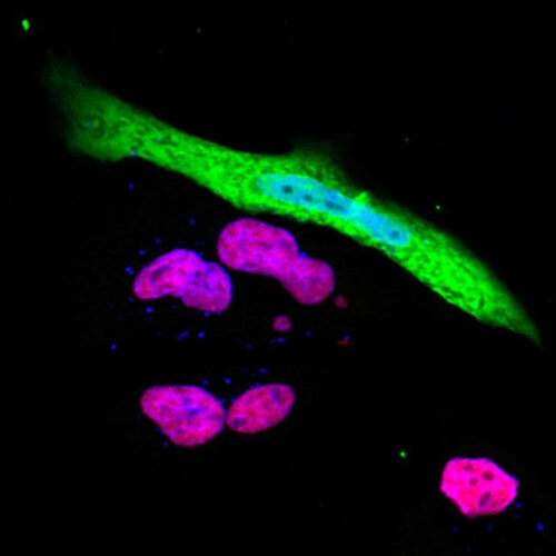 COVID-19 Breakthrough: Scientists Discover How the SARS-CoV-2 Virus Evades Our Immune System