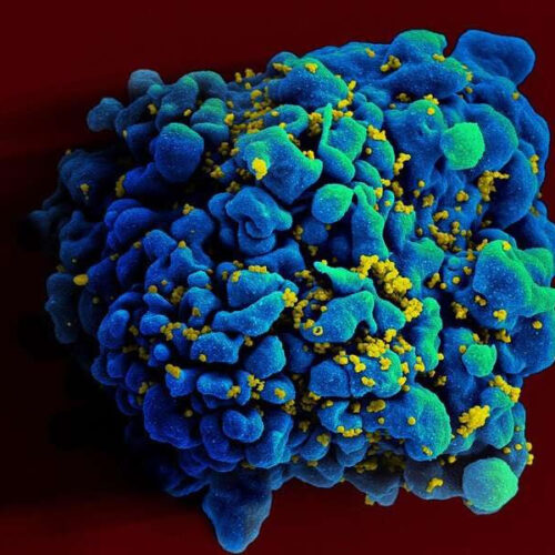 Experimental mRNA HIV vaccine safe, shows promise in animals