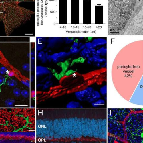 Retinal immune cells may hold key to preventing diabetes-related vision loss