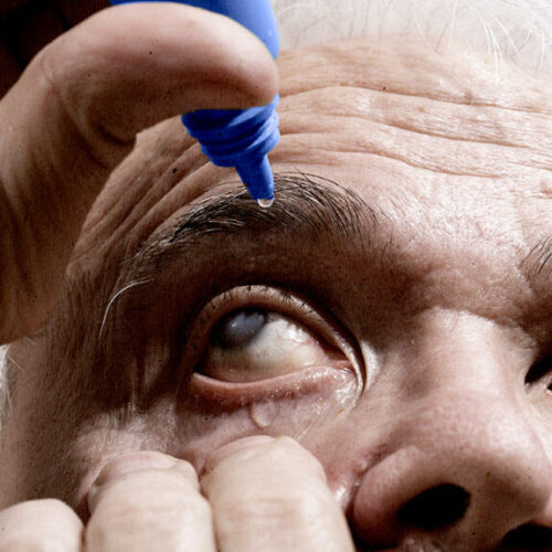 What to know about dry eye gel drops and what conditions they treat