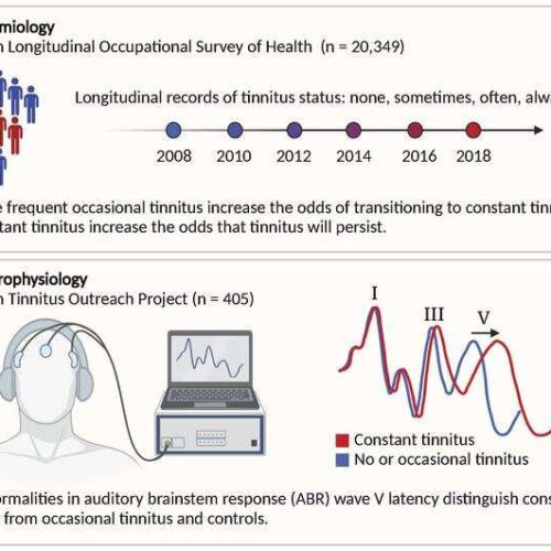 Constant tinnitus is linked to altered brain activity