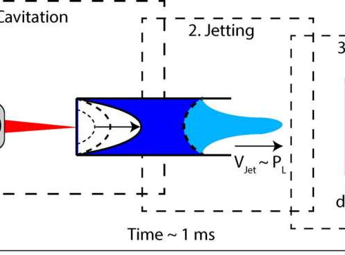 Needle-free injection evolves toward a highly precise, safe and low-waste technology