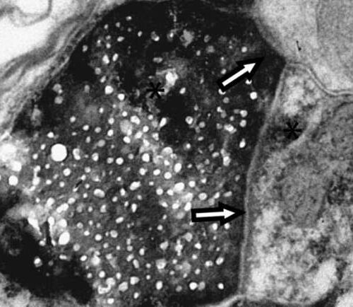 Researchers discover new type of cellular communication in the brain