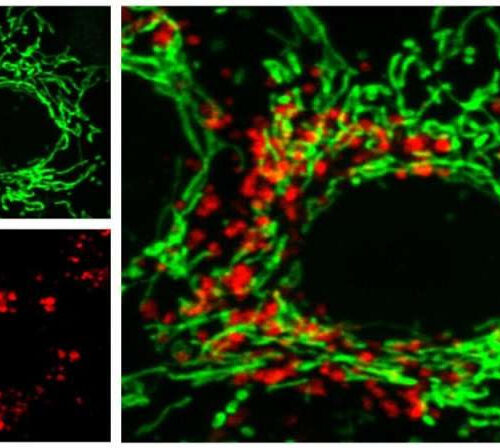 A new method for treating Alzheimer’s disease