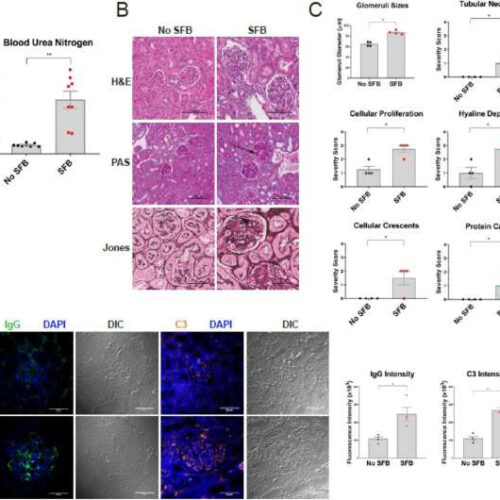 How changing gut microbiota can affect lupus disease activity in mice