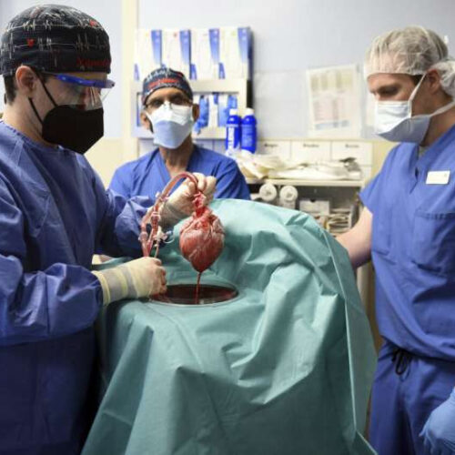 In 1st, US surgeons transplant pig heart into human patient