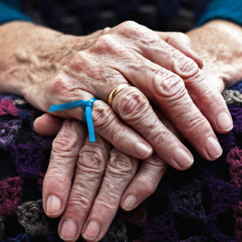 Dementia cases set to triple by 2050