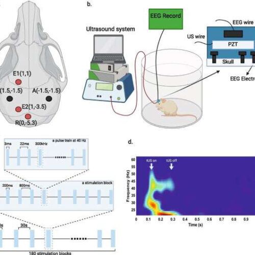 Transcranial ultrasound used in mice with Alzheimer’s disease features