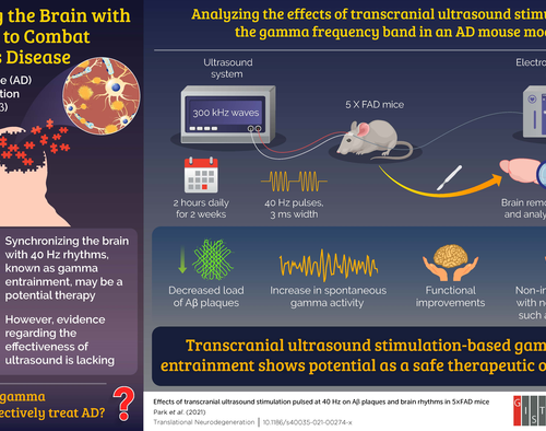 Researchers from the GIST propose ultrasound stimulation as an effective therapy for Alzheimer’s disease in new study