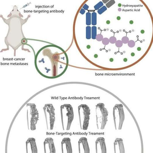 Antibody with engineered peptide targets bone metastasis