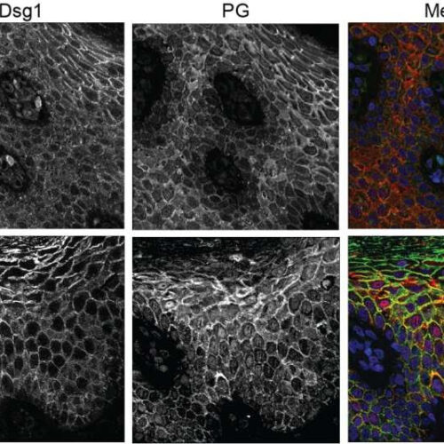 Uncovering cellular mechanisms of genetic skin diseases