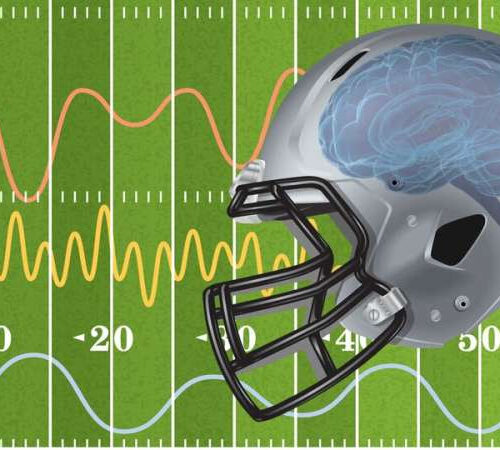 EEG analysis may detect up to 99.5 percent of concussions