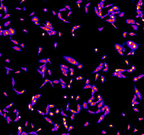 Researchers reduce breast cancer metastasis in animal models by modifying tumor electrical properties