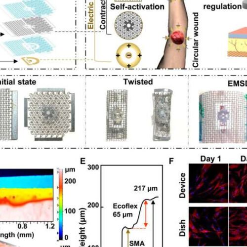 An electrically charged thin film patch used to promote wound healing