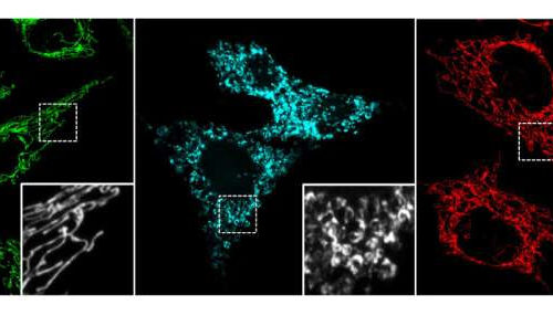 Active ingredient in cannabis protects aging brain cells