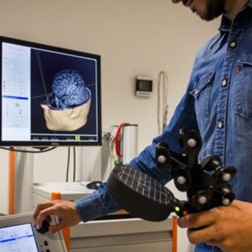 Study detects how a genetic variant modifies the brain stimulation impact on memory