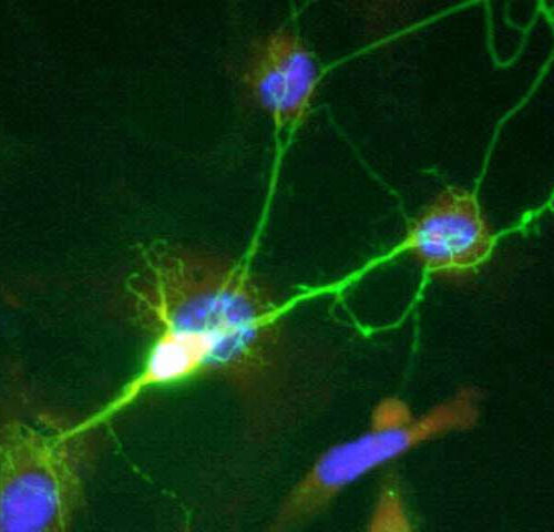 Like tiny drill sergeants, neurons identified in spinal cord coordinate our steps