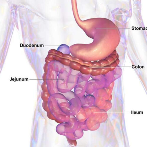 Inflammatory bowel disease: Incidence and treatment