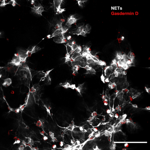 Study presents novel therapeutic target for treatment of sepsis