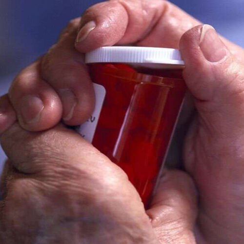 2 rheumatoid arthritis drugs tied to lower risk of Parkinson’s