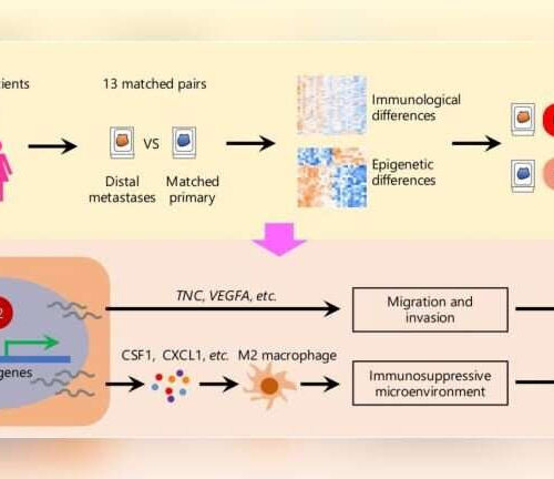 New path to treat advanced triple-negative breast cancer