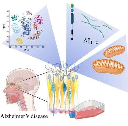 Human olfactory mucosa cell model opens a new perspective on Alzheimer’s disease