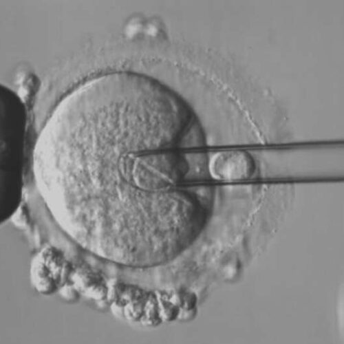 ‘Maeve’s law’ would let IVF parents access technology to prevent mitochondrial disease