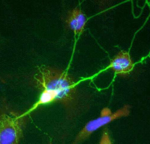 Myelination found to determine the nerve cell power of inhibition