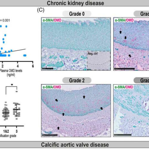 Osteomodulin is a novel biomarker of vascular calcification