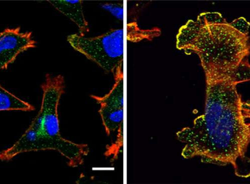 To slow cancer, close the cells’ tunnels