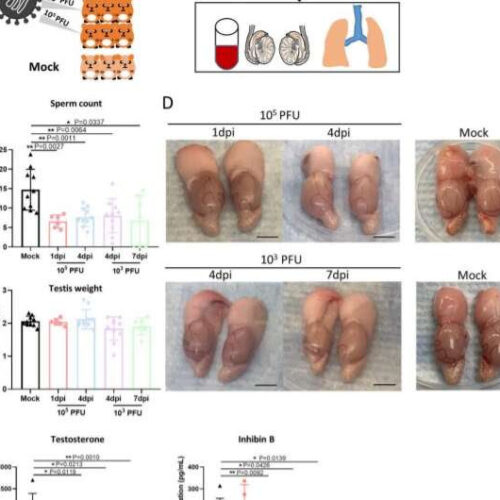 Researchers find COVID-19 virus causing testicular damage and atrophy