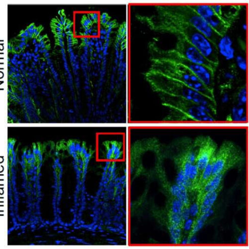 Scientists reveal mechanism for colon pain and inflammation